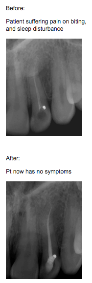 endodontics