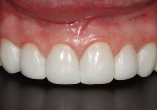 After -The Houston Group