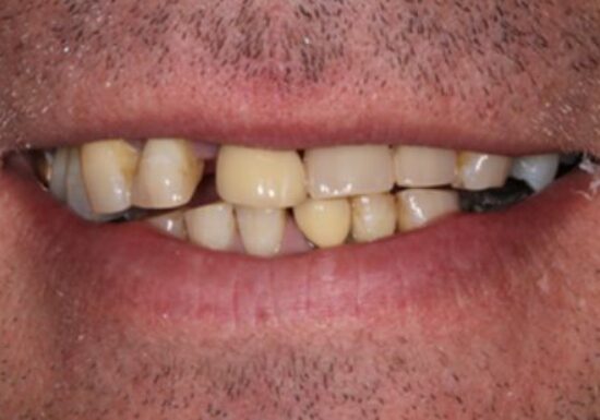 Before - The Houston Group