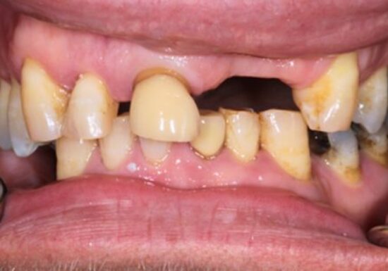 Before - The Houston Group